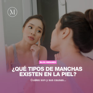 Qué tipos de manchas existen en la piel